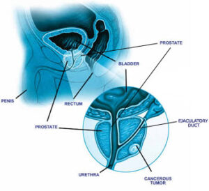 Prostate Diagram | Men’s Hormonal Health